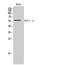 Chaperonin Containing TCP1 Subunit 7 antibody, A08169-1, Boster Biological Technology, Western Blot image 