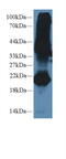 Gremlin 1, DAN Family BMP Antagonist antibody, MBS2005264, MyBioSource, Western Blot image 