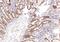 PMS1 Homolog 2, Mismatch Repair System Component antibody, 34078, QED Bioscience, Immunohistochemistry paraffin image 