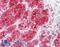 Fms Related Tyrosine Kinase 3 antibody, LS-B8864, Lifespan Biosciences, Immunohistochemistry paraffin image 