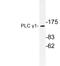 Phospholipase C Gamma 1 antibody, LS-C176572, Lifespan Biosciences, Western Blot image 