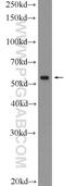 Vitamin D Receptor antibody, 14526-1-AP, Proteintech Group, Western Blot image 