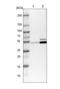 Transcription Factor AP-2 Beta antibody, NBP1-89063, Novus Biologicals, Western Blot image 