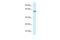 FERM Domain Containing 5 antibody, A14848, Boster Biological Technology, Western Blot image 