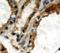 Thyroglobulin antibody, LS-C348613, Lifespan Biosciences, Immunohistochemistry paraffin image 