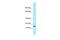 Variable Charge Y-Linked 1B antibody, PA5-70710, Invitrogen Antibodies, Western Blot image 