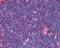 TNF Receptor Superfamily Member 8 antibody, 49-104, ProSci, Immunohistochemistry frozen image 
