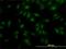 Male Germ Cell Associated Kinase antibody, H00004117-M02, Novus Biologicals, Immunocytochemistry image 