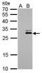 Kallikrein Related Peptidase 7 antibody, PA5-27252, Invitrogen Antibodies, Western Blot image 
