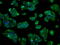 Cytochrome P450 Family 2 Subfamily E Member 1 antibody, GTX84634, GeneTex, Immunofluorescence image 