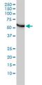 Chaperonin Containing TCP1 Subunit 5 antibody, H00022948-M01, Novus Biologicals, Western Blot image 