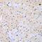 Cdc42 Guanine Nucleotide Exchange Factor 9 antibody, GTX33018, GeneTex, Immunohistochemistry paraffin image 