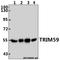 Tripartite Motif Containing 59 antibody, A07207-1, Boster Biological Technology, Western Blot image 