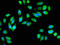 Isocitrate Dehydrogenase (NAD(+)) 3 Alpha antibody, orb400476, Biorbyt, Immunofluorescence image 