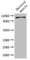 EPH Receptor B6 antibody, CSB-PA007733LA01HU, Cusabio, Western Blot image 