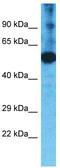 Transmembrane Serine Protease 11F antibody, TA330795, Origene, Western Blot image 