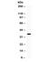 Galectin 9 antibody, R31782, NSJ Bioreagents, Western Blot image 