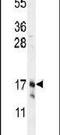Claudin 7 antibody, PA5-23689, Invitrogen Antibodies, Western Blot image 