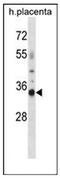 Olfactory Receptor Family 4 Subfamily K Member 13 antibody, AP53057PU-N, Origene, Western Blot image 