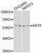 Lysine Acetyltransferase 8 antibody, MBS128140, MyBioSource, Western Blot image 