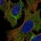 p101-PI3K antibody, HPA044505, Atlas Antibodies, Immunocytochemistry image 