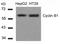Cycb1 antibody, GTX50663, GeneTex, Western Blot image 