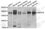 MER Proto-Oncogene, Tyrosine Kinase antibody, A5443, ABclonal Technology, Western Blot image 
