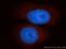 Catenin alpha-3 antibody, 13974-1-AP, Proteintech Group, Immunofluorescence image 