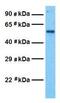 Gamma-Aminobutyric Acid Type A Receptor Delta Subunit antibody, GTX77695, GeneTex, Western Blot image 