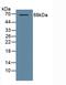 ADAM Metallopeptidase Domain 10 antibody, LS-B13920, Lifespan Biosciences, Western Blot image 