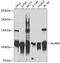 Nucleoporin 98 antibody, 23-970, ProSci, Western Blot image 