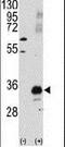 Pim-1 Proto-Oncogene, Serine/Threonine Kinase antibody, PA5-15123, Invitrogen Antibodies, Western Blot image 