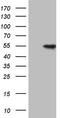 Serine/threonine-protein kinase 51PK antibody, TA805791, Origene, Western Blot image 