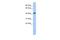 LIM/homeobox protein Lhx4 antibody, A05503, Boster Biological Technology, Western Blot image 