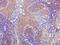 Sialophorin antibody, M01296-1, Boster Biological Technology, Immunohistochemistry paraffin image 