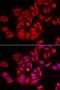 Tousled Like Kinase 2 antibody, orb247620, Biorbyt, Immunofluorescence image 