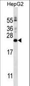 Phosphatidylinositol Glycan Anchor Biosynthesis Class H antibody, LS-C163713, Lifespan Biosciences, Western Blot image 