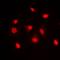 Dyskerin Pseudouridine Synthase 1 antibody, LS-C368647, Lifespan Biosciences, Immunofluorescence image 