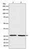 BCL2 Interacting Protein 1 antibody, M09220, Boster Biological Technology, Western Blot image 