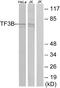 BRF1 RNA Polymerase III Transcription Initiation Factor Subunit antibody, A30544, Boster Biological Technology, Western Blot image 