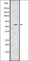 Catalase antibody, orb336632, Biorbyt, Western Blot image 