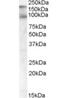 CUB Domain Containing Protein 1 antibody, orb18721, Biorbyt, Western Blot image 