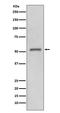 Matrix Metallopeptidase 11 antibody, M04490, Boster Biological Technology, Western Blot image 