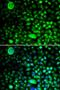 Calcium Voltage-Gated Channel Auxiliary Subunit Gamma 2 antibody, LS-C346113, Lifespan Biosciences, Immunofluorescence image 