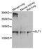 Fms Related Tyrosine Kinase 1 antibody, abx124272, Abbexa, Western Blot image 
