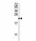 Triggering Receptor Expressed On Myeloid Cells 2 antibody, F49197-0.4ML, NSJ Bioreagents, Western Blot image 