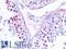 DNA Topoisomerase II Alpha antibody, LS-B16084, Lifespan Biosciences, Immunohistochemistry paraffin image 