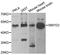 SET And MYND Domain Containing 2 antibody, A6474, ABclonal Technology, Western Blot image 