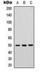 Protein Tyrosine Phosphatase Non-Receptor Type 1 antibody, LS-C358259, Lifespan Biosciences, Western Blot image 