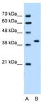 RUN domain-containing protein 2A antibody, TA342482, Origene, Western Blot image 
